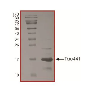 SDS-PAGE - Recombinant Human Tau protein (His tag N-Terminus) (AB268998)