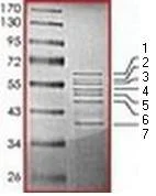 SDS-PAGE - Recombinant Human Tau441 (mutated V337M) protein (AB172193)