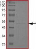 SDS-PAGE - Recombinant Human Tau441 protein (AB172194)