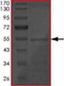 SDS-PAGE - Recombinant Human Tau441 protein (AB172195), expandable thumbnail