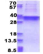 SDS-PAGE - Recombinant Human TBC1D1 protein (denatured) (His tag N-Terminus) (AB176041)