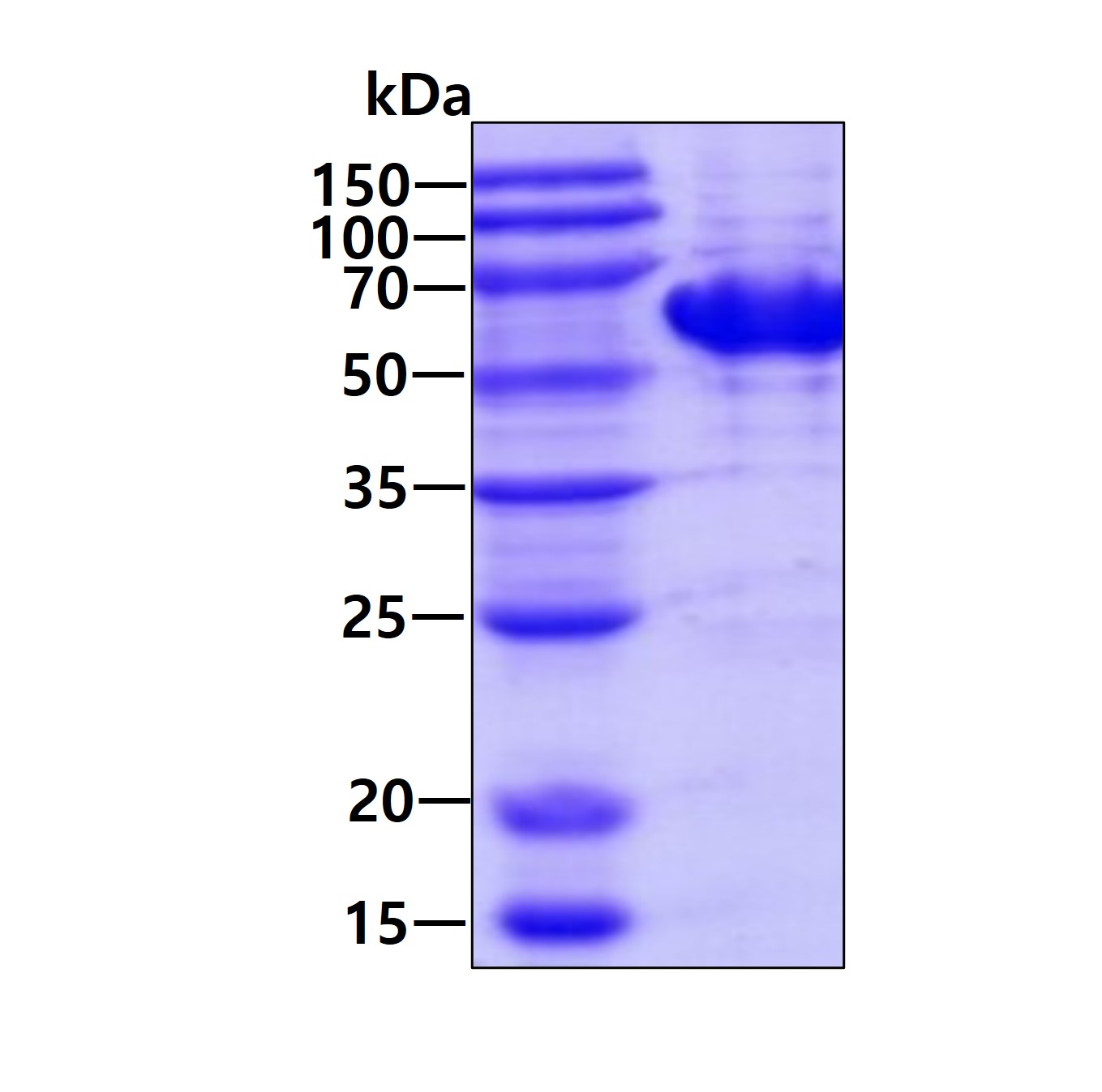 SDS-PAGE - Recombinant Human TBC1D22B protein (AB202146)
