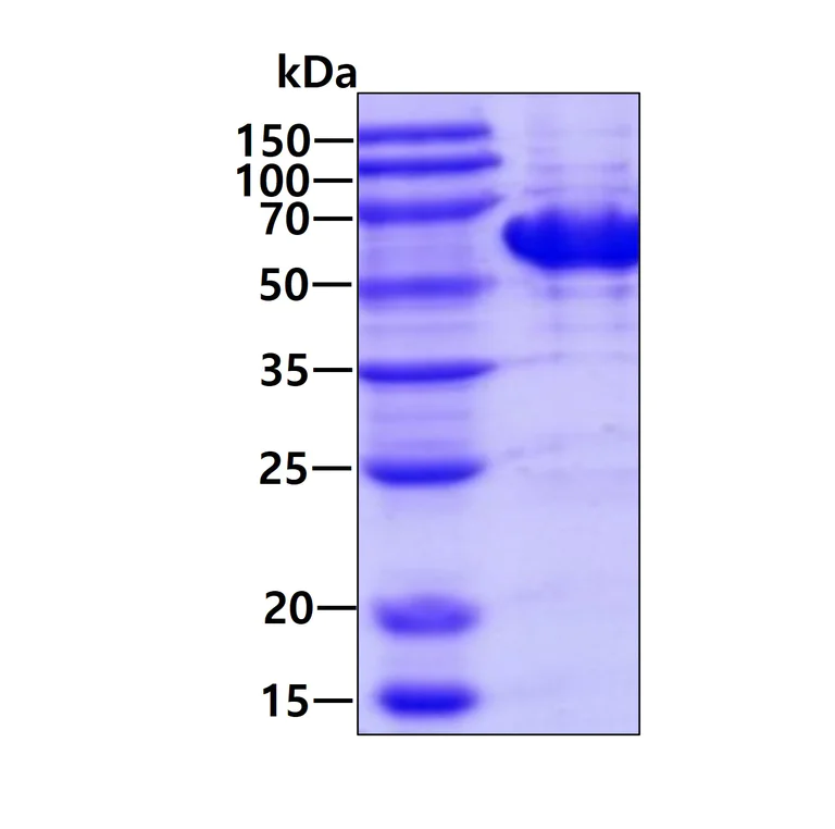 SDS-PAGE - Recombinant Human TBC1D22B protein (AB202146)