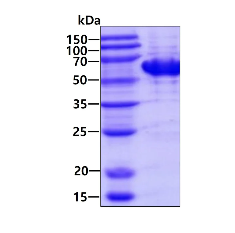 SDS-PAGE - Recombinant Human TBC1D22B protein (AB202146)