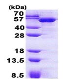 Recombinant Human TBCEL protein