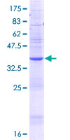 SDS-PAGE - Recombinant Human TBLR1/TBL1XR1 protein (GST tag N-Terminus) (AB153511)