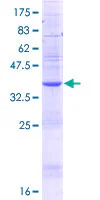 SDS-PAGE - Recombinant Human TBLR1/TBL1XR1 protein (GST tag N-Terminus) (AB153511)