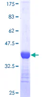 SDS-PAGE - Recombinant Human TBR2 / Eomes protein (GST tag N-Terminus) (AB152851)