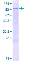 SDS-PAGE - Recombinant Human TBRG4 protein (AB132734)