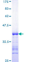 SDS-PAGE - Recombinant Human Tbx2 protein (AB159642), expandable thumbnail