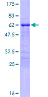SDS-PAGE - Recombinant Human Tbx20 protein (AB132480)