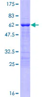 SDS-PAGE - Recombinant Human Tbx20 protein (GST tag N-Terminus) (AB132480)