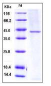 SDS-PAGE - Recombinant Human TC-2 protein (His tag) (AB276296), expandable thumbnail