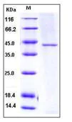 SDS-PAGE - Recombinant Human TC-2 protein (His tag) (AB276296)