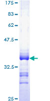 Recombinant Human TC1 protein