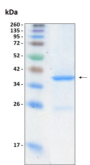 SDS-PAGE - Recombinant Human TCEAL2 protein (His tag) (AB204770), expandable thumbnail