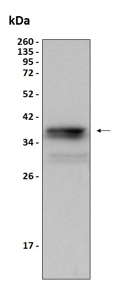 Western blot - Recombinant Human TCEAL2 protein (His tag) (AB204770), expandable thumbnail