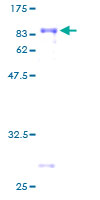 SDS-PAGE - Recombinant Human TCF-4/TCF7L2 protein (GST tag N-Terminus) (AB159648)