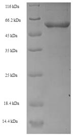 SDS-PAGE - Recombinant Human TCN1 protein (Tagged) (AB236331)