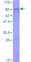 SDS-PAGE - Recombinant Human TCP1 eta protein (AB161051), expandable thumbnail