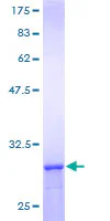 SDS-PAGE - Recombinant Human TCP1 theta protein (GST tag N-Terminus) (AB161115)