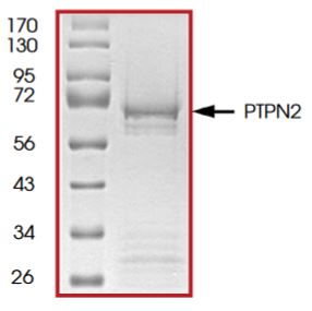 SDS-PAGE - Recombinant human TCPTP protein (Tagged) (AB268903), expandable thumbnail