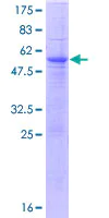 SDS-PAGE - Recombinant Human TCR alpha protein (AB112358)