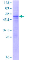 SDS-PAGE - Recombinant Human TCR alpha protein (GST tag N-Terminus) (AB112358)