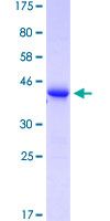SDS-PAGE - Recombinant Human TCR V delta 1 protein (GST tag N-Terminus) (AB159659)