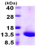 SDS-PAGE - Recombinant Human TCTEX-1 protein (His tag N-Terminus) (AB106872)