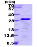 SDS-PAGE - Recombinant Human TCTP protein (AB93454)