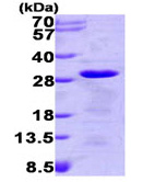 SDS-PAGE - Recombinant Human TCTP protein (His tag N-Terminus) (AB93454)