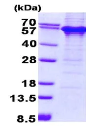 SDS-PAGE - Recombinant Human TDG protein (denatured) (His tag N-Terminus) (AB134525)
