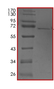 SDS-PAGE - Recombinant Human TDO2/TDO protein (AB204162)