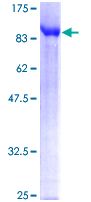 SDS-PAGE - Recombinant Human TDP1 protein (AB131921)