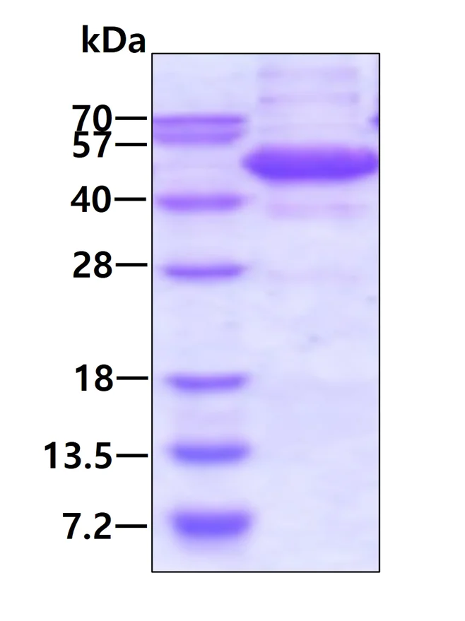 SDS-PAGE - Recombinant Human TDP2 protein (His tag N-Terminus) (AB140722)
