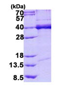 SDS-PAGE - Recombinant Human TDP43 protein (AB140718), expandable thumbnail