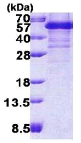 SDS-PAGE - Recombinant Human TDP43 protein (denatured) (His tag N-Terminus) (AB156345)