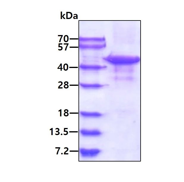 SDS-PAGE - Recombinant Human TDP43 protein (Tag Free) (AB224788)