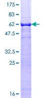 SDS-PAGE - Recombinant Human TEAD3 protein (GST tag N-Terminus) (AB159663)