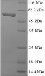 SDS-PAGE - Recombinant Human TEAD4 protein (His tag) (AB238222), expandable thumbnail