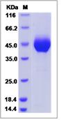 SDS-PAGE - Recombinant Human TECTB protein (His tag) (AB276695)