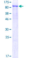 Recombinant Human TEM1 protein