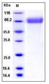 SDS-PAGE - Recombinant Human TEM7 protein (His tag) (AB276426)