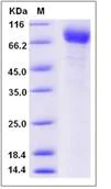 SDS-PAGE - Recombinant Human TEM8/ATR protein (Fc Chimera) (AB276533)