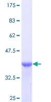 SDS-PAGE - Recombinant Human Tenascin C protein (GST tag N-Terminus) (AB114943)