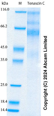 SDS-PAGE - Recombinant Human Tenascin C Protein Standard (His tag) (AB322746), expandable thumbnail