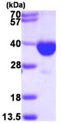 SDS-PAGE - Recombinant Human TERP protein (His tag N-Terminus) (AB113128)