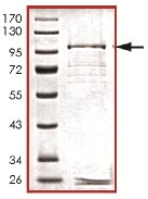 SDS-PAGE - Recombinant Human TESK1 protein (AB125542), expandable thumbnail