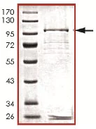 SDS-PAGE - Recombinant Human TESK1 protein (AB125542)